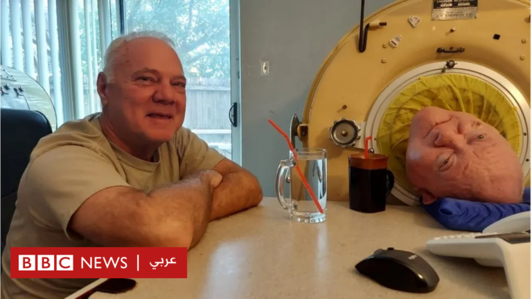 القصة المذهلة لرجل حطم الرقم القياسي بالعيش أكثر من سبعين عاماً في رئة حديدية

